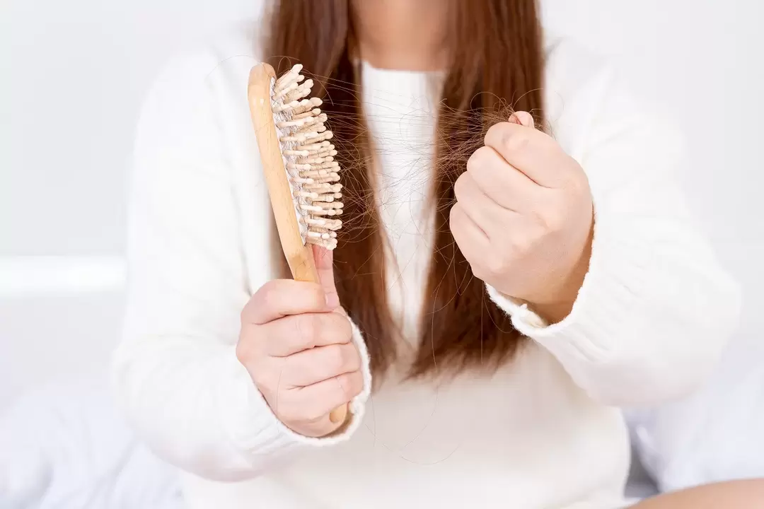 Haarausfall und Behandlung mit einem Verdexedil